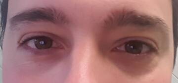 Public Photo of Mrblackeyes1